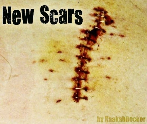 New Scars