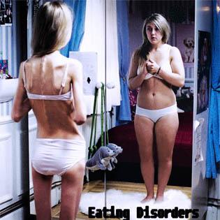 Eating Disorders-distúrbios Alimentares